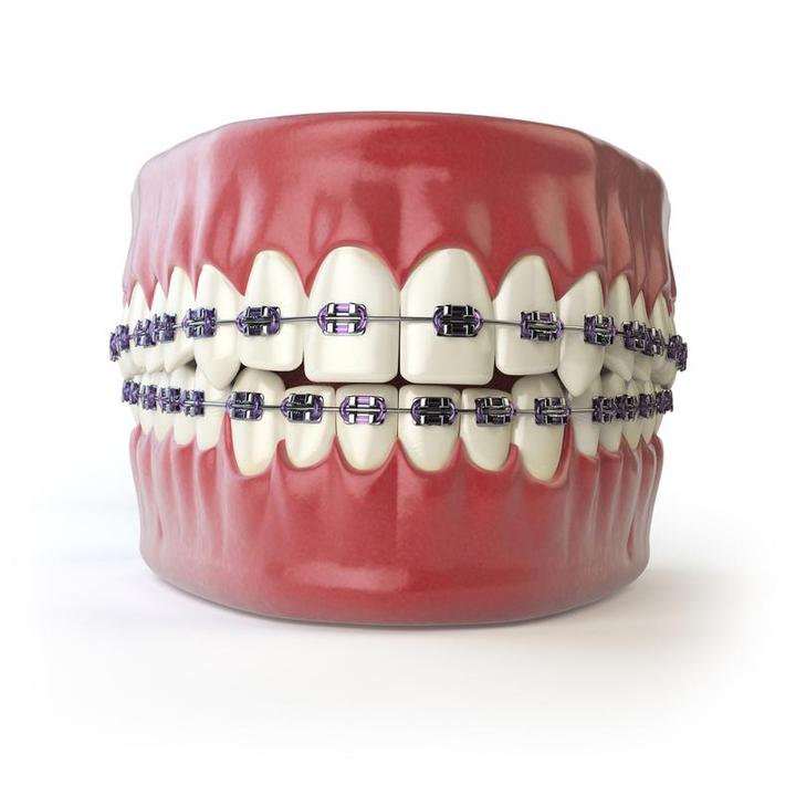 牙博士价目表,箍牙需要多少钱